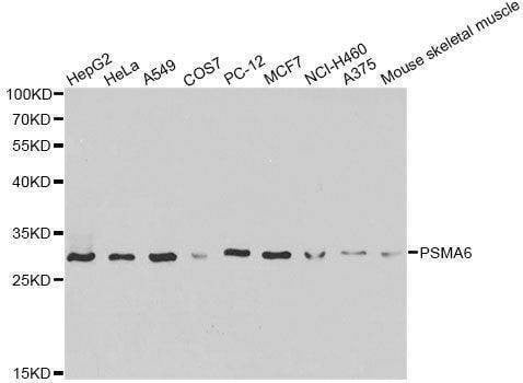 Anti-PSMA6 Antibody