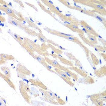 Anti-TRIM21 Antibody