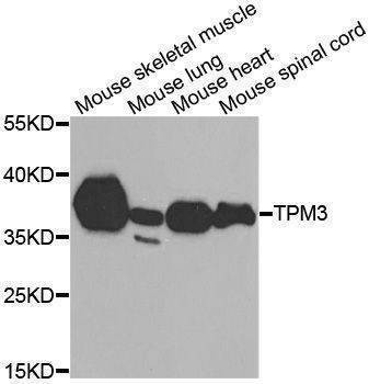 Anti-TPM3 Antibody