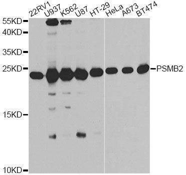 Anti-PSMB2 Antibody