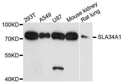 Anti-SLC34A1 Antibody