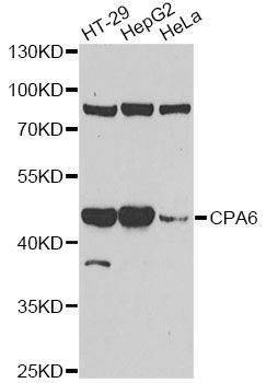 Anti-CPA6 Antibody