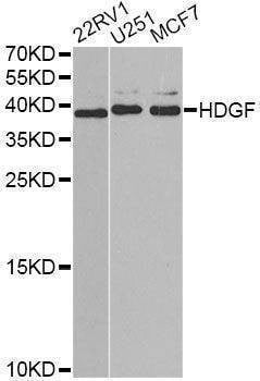 Anti-HDGF Antibody