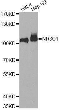 Anti-NR3C1 Antibody