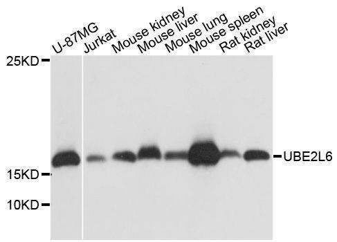 Anti-UBE2L6 Antibody