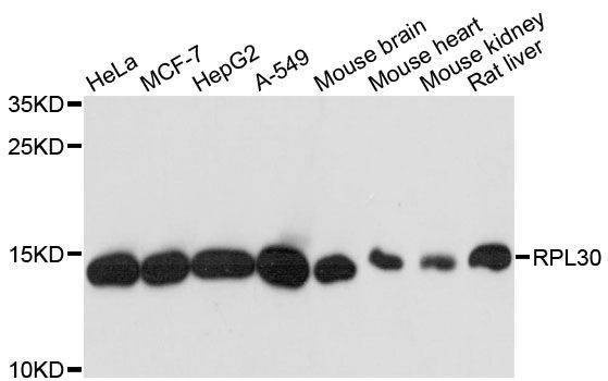 Anti-RPL30 Antibody