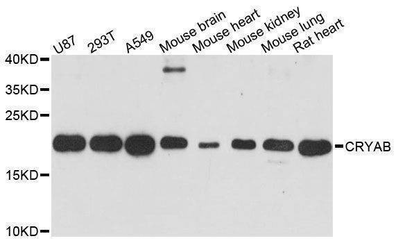 Anti-CRYAB Antibody