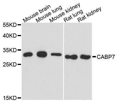 Anti-CABP7 Antibody