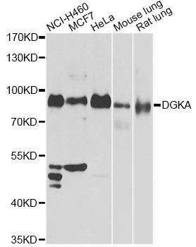Anti-DGKA Antibody