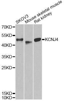 Anti-KCNJ4 Antibody
