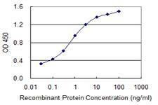 Anti-CRYGC Antibody