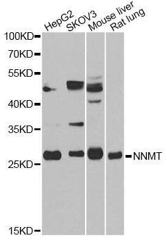 Anti-NNMT Antibody