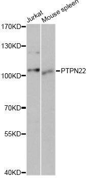 Anti-PTPN22 Antibody