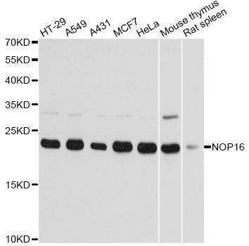 Anti-NOP16 Antibody