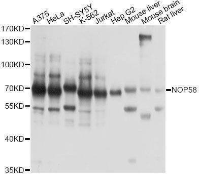 Anti-NOP58 Antibody