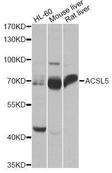 Anti-ACSL5 Antibody
