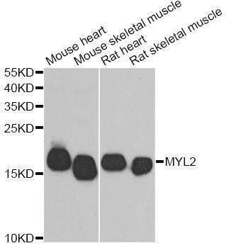 Anti-MYL2 Antibody
