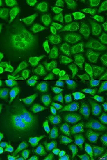 Anti-UBIAD1 Antibody