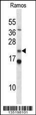 Anti-COPS8 (N-term) Antibody