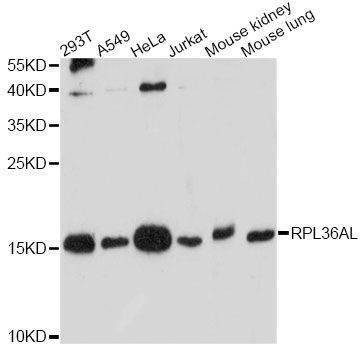 Anti-RPL36AL Antibody