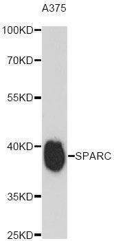 Anti-SPARC Antibody