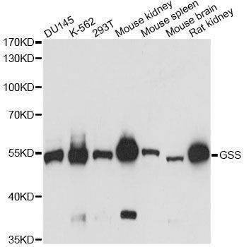 Anti-GSS Antibody