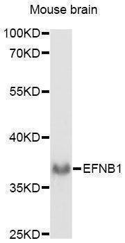 Anti-EFNB1 Antibody