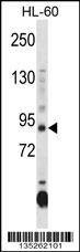 Anti-DNMT3A (CenterR478) Antibody