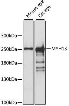Anti-MYH13 Antibody