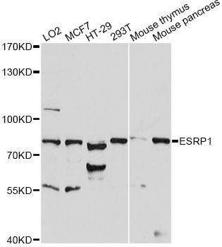 Anti-ESRP1 Antibody