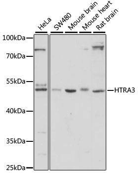 Anti-HTRA3 Antibody