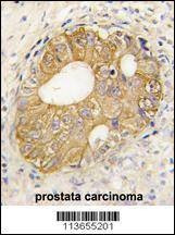 Anti-CDH3 (N-term) Antibody