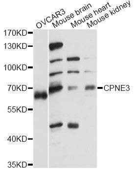 Anti-CPNE3 Antibody