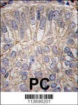 Anti-CDH3 (C-term) Antibody