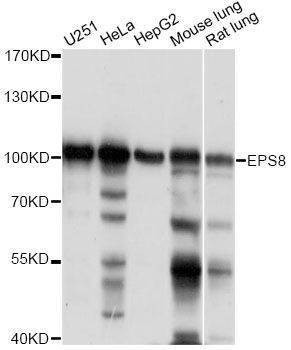 Anti-EPS8 Antibody