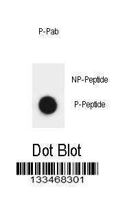 Anti-Phospho-ATRIP (S239) Antibody