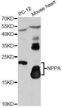 Anti-NPPA Antibody