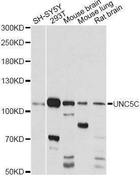 Anti-UNC5C Antibody