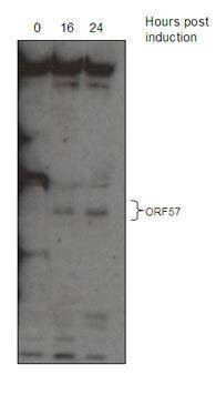 Anti-KSHV ORF 57 Antibody