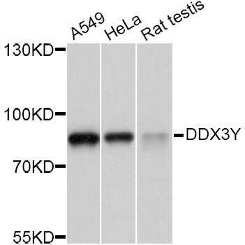 Anti-DDX3Y Antibody