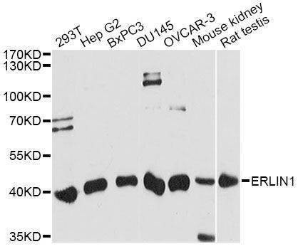 Anti-ERLIN1 Antibody