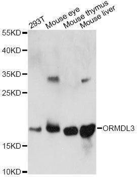 Anti-ORMDL3 Antibody