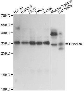 Anti-TP53RK Antibody