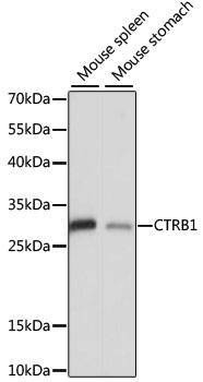 Anti-CTRB1 Antibody