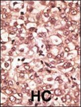 Anti-TLR6 (C-term) Antibody