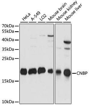 Anti-CNBP Antibody