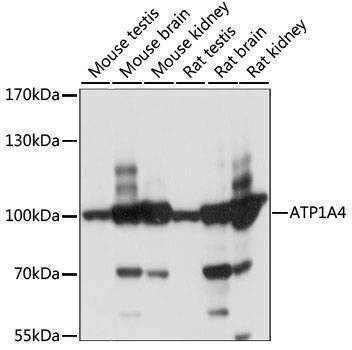 Anti-ATP1A4 Antibody