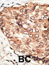 Anti-STAT5b (C-term) Antibody