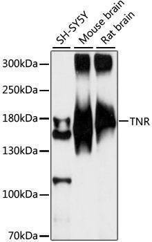 Anti-TNR Antibody