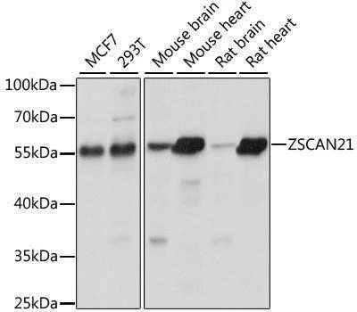 Anti-ZSCAN21 Antibody